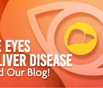 The eyes in liver disease. Read our blog!